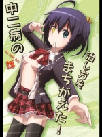 中二病 中二病の治し方をまちがえた!